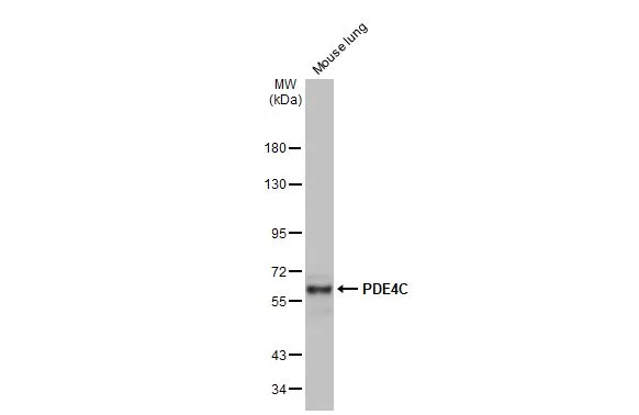 Mouse tissue extract (50 μg) was separated by 7.5% SDS-PAGE, and the membrane was blotted with PDE4C antibody [N3C3] (GTX106268) diluted at 1:1000. The HRP-conjugated anti-rabbit IgG antibody (GTX213110-01) was used to detect the primary antibody.