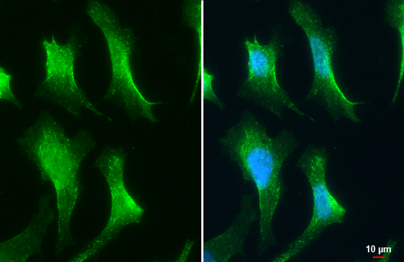 VPS26 antibody [C2C3], C-term detects VPS26 protein at Endosome by immunofluorescent analysis. Sample: HeLa cells were fixed in 4% paraformaldehyde at RT for 15 min. Green: VPS26 stained by VPS26 antibody [C2C3], C-term (GTX106297) diluted at 1:1000.