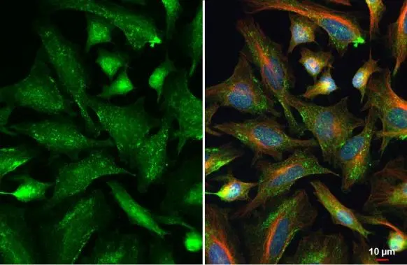 VPS26 antibody [C2C3], C-term detects VPS26 protein at endosome by immunofluorescent analysis. Sample: HeLa cells were fixed in ice-cold MeOH for 5 min. Green: VPS26 stained by VPS26 antibody [C2C3], C-term (GTX106297) diluted at 1:500. Red: alpha Tubulin, a cytoskeleton marker, stained by alpha Tubulin antibody [GT114] (GTX628802) diluted at 1:1000. Blue: Fluoroshield with DAPI (GTX30920).
