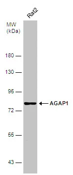 Whole cell extract (50 μg) was separated by 7.5% SDS-PAGE, and the membrane was blotted with AGAP1 antibody [C3], C-term (GTX106298) diluted at 1:1000.