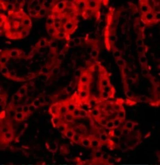 IHC-P analysis of mouse kidney tissue using GTX10632 IRF3 antibody. Working concentration : 20 microg/ml IHC-P analysis of mouse kidney tissue using GTX10632 IRF3 antibody. Working concentration : 20 microg/ml