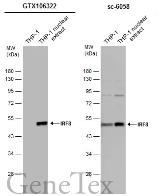 THP-1 whole cell and nuclear extracts (30 μg) were separated by 10% SDS-PAGE, and the membranes were blotted with IRF8 antibody [C3], C-term (GTX106322) diluted at 1:500 and competitor's antibody (sc-6058) diluted at 1:100. The HRP-conjugated anti-rabbit IgG antibody (GTX213110-01) was used to detect the primary antibody.