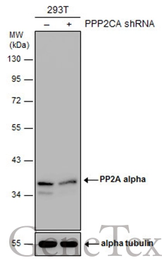 Non-transfected (–) and transfected (+) 293T whole cell extracts (30 μg) were separated by 10% SDS-PAGE, and the membrane was blotted with PP2A alpha antibody (GTX106334) diluted at 1:2000. The HRP-conjugated anti-rabbit IgG antibody (GTX213110-01) was used to detect the primary antibody.