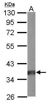 Sample (50 μg of whole cell lysate) A: mouse brain 10% SDS PAGE GTX106334 diluted at 1:10000 The HRP-conjugated anti-rabbit IgG antibody (GTX213110-01) was used to detect the primary antibody. Sample (50 μg of whole cell lysate) A: mouse brain 10% SDS PAGE GTX106334 diluted at 1:10000 The HRP-conjugated anti-rabbit IgG antibody (GTX213110-01) was used to detect the primary antibody.