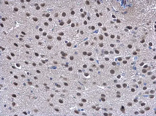 TRIP15 antibody detects TRIP15 protein at cytoplasm and nucleus on mouse fore brain by immunohistochemical analysis. Sample: Paraffin-embedded mouse fore brain. TRIP15 antibody (GTX106361) diluted at 1:500. 
 Antigen Retrieval: Trilogy? (EDTA based, pH 8.0) buffer, 15min