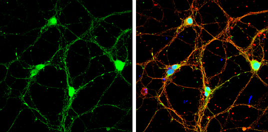 Syntaxin 1a antibody [N1], N-term detects Syntaxin 1a protein at cell body and synaptic vesicles by immunofluorescent analysis. Sample: DIV9 rat E18 primary cortical neurons were fixed in 4% paraformaldehyde at RT for 15 min. Green: Syntaxin 1a protein stained by Syntaxin 1a antibody [N1], N-term (GTX106365) diluted at 1:500. Red: beta Tubulin 3/ Tuj1, a neuron cell marker, stained by beta Tubulin 3/ Tuj1 antibody [GT11710] (GTX631836) diluted at 1:500. Blue: Fluoroshield with DAPI (GTX30920).