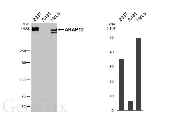 Various whole cell extracts (30 μg) were separated by 5% SDS-PAGE, and the membrane was blotted with AKAP12 antibody [C3] (GTX106373) diluted at 1:1000. The HRP-conjugated anti-rabbit IgG antibody (GTX213110-01) was used to detect the primary antibody.