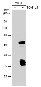 Non-transfected (–) and transfected (+) 293T whole cell extracts (30 μg) were separated by 10% SDS-PAGE, and the membrane was blotted with TOM1L1 antibody [C3], C-term (GTX106377) diluted at 1:5000. The HRP-conjugated anti-rabbit IgG antibody (GTX213110-01) was used to detect the primary antibody.