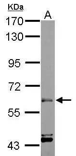 Sample (50 ug of whole cell lysate) A: mouse muscle 7.5% SDS PAGE GTX106404 diluted at 1:1000