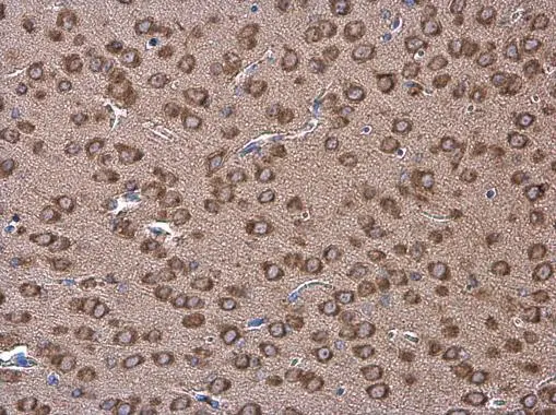 Coronin 1A antibody [C3], C-term detects Coronin 1A protein at cytoplasm in mouse brain by immunohistochemical analysis. Sample: Paraffin-embedded mouse brain. Coronin 1A antibody [C3], C-term (GTX106424) diluted at 1:500. 
 Antigen Retrieval: Citrate buffer, pH 6.0, 15 min