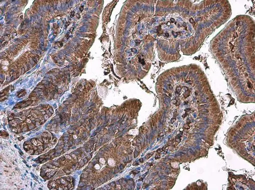 Coronin 1A antibody [C3], C-term detects Coronin 1A protein at cytoplasm in mouse duodenum by immunohistochemical analysis. Sample: Paraffin-embedded mouse duodenum. Coronin 1A antibody [C3], C-term (GTX106424) diluted at 1:500. 
 Antigen Retrieval: Citrate buffer, pH 6.0, 15 min