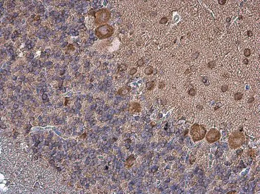 Coronin 1A antibody [C3], C-term detects Coronin 1A protein at cytoplasm in rat brain by immunohistochemical analysis. Sample: Paraffin-embedded rat brain. Coronin 1A antibody [C3], C-term (GTX106424) diluted at 1:500. 
 Antigen Retrieval: Citrate buffer, pH 6.0, 15 min
