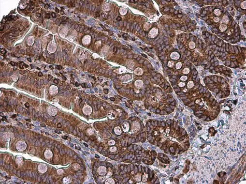 Coronin 1A antibody [C3], C-term detects Coronin 1A protein at cytoplasm in rat intestine by immunohistochemical analysis. Sample: Paraffin-embedded rat intestine. Coronin 1A antibody [C3], C-term (GTX106424) diluted at 1:500. 
 Antigen Retrieval: Citrate buffer, pH 6.0, 15 min