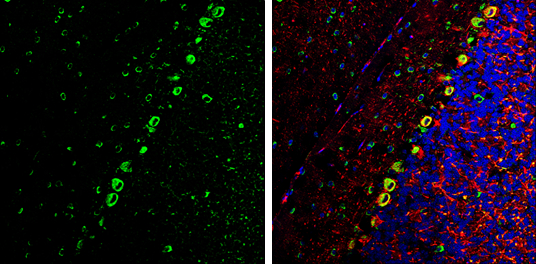 Coronin 1A antibody [C3], C-term detects Coronin 1A Protein expression by immunohistochemical analysis. Sample: Frozen-sectioned adult mouse cerebellum. Green: Coronin 1A stained by Coronin 1A antibody [C3], C-term (GTX106424) diluted at 1:250. Red: NF-H, stained by NF-H antibody [GT114] (GTX634289) diluted at 1:500. Blue: Fluoroshield with DAPI (GTX30920). 
 Antigen Retrieval: Citrate buffer, pH 6.0, 10 min