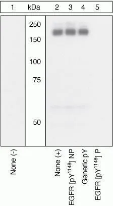 WB (peptide competition) analysis of A431 cells stimulated with 200 ng/mL EGF (Lane 2-5) for 15 minutes using GTX10643 EGFR (phospho Tyr1148) antibody prior incubated with, non-phosphopeptide corresponding to the phosphopeptide immunogen (Lane 3), a generic phosphotyrosine-containing peptide (Lane 4), or the phosphopeptide immunogen (Lane 5) control. The data show that only the immunogen phosphopeptide blocks the signal, demonstrating the specificity of the antibody. WB (peptide competition) analysis of A431 cells stimulated with 200 ng/mL EGF (Lane 2-5) for 15 minutes using GTX10643 EGFR (phospho Tyr1148) antibody prior incubated with, non-phosphopeptide corresponding to the phosphopeptide immunogen (Lane 3), a generic phosphotyrosine-containing peptide (Lane 4), or the phosphopeptide immunogen (Lane 5) control. The data show that only the immunogen phosphopeptide blocks the signal, demonstrating the specificity of the antibody.