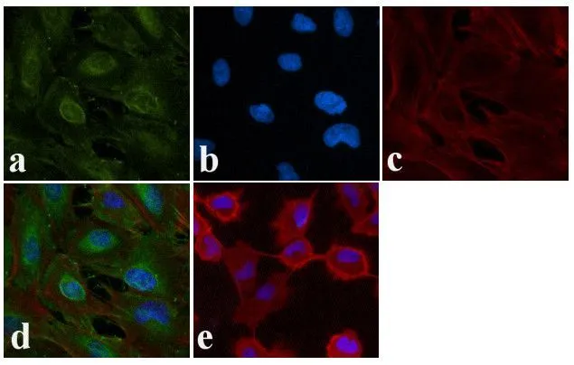 ICC/IF analysis of A549 cells using GTX10643 EGFR (phospho Tyr1148) antibody. Panel e is a no primary antibody control. Green : Primary antibody Blue : Nuclei Red : Actin Fixation : 4% paraformaldehyde Permeabilization : 0.25% Trito X-100 for 10 minutes Dilution : 1:400 for 30 minutes at room temperature