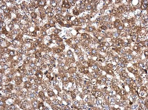 AKAP10 antibody [C3], C-term detects AKAP10 protein at cytoplasm in rat liver by immunohistochemical analysis. Sample: Paraffin-embedded rat liver. AKAP10 antibody [C3], C-term (GTX106430) diluted at 1:100. 
 Antigen Retrieval: Citrate buffer, pH 6.0, 15 min