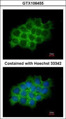 SEC61A1 antibody