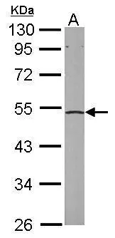 Sample (50 ug of whole cell lysate) A: mouse liver 10% SDS PAGE GTX106484 diluted at 1:1000