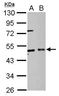 EIF2 beta antibody detects EIF2S2 protein by Western blot analysis. A. 30 ug PC-12 whole cell lysate/extract B. 30 ug Rat2 whole cell lysate/extract 10 % SDS-PAGE EIF2 beta antibody (GTX106484) dilution: 1:2000