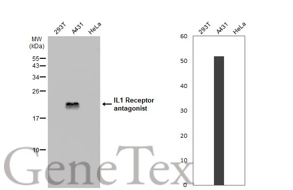 IL1 Receptor antagonist antibody