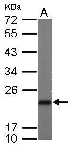 Sample (50 ug of whole cell lysate) A: mouse brain 12% SDS PAGE GTX106550 diluted at 1:5000 Sample (50 ug of whole cell lysate) A: mouse brain 12% SDS PAGE GTX106550 diluted at 1:5000