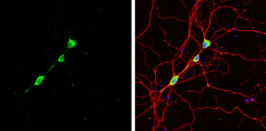 Staufen antibody detects Staufen protein by immunofluorescent analysis. Sample: DIV9 rat E18 primary hippocampal neuron cells were fixed in 4% paraformaldehyde at RT for 15 min. Green: Staufen stained by Staufen antibody (GTX106566) diluted at 1:500. Red: beta Tubulin 3/ Tuj1, stained by beta Tubulin 3/ Tuj1 antibody [GT11710] (GTX631836) diluted at 1:500. Blue: Fluoroshield with DAPI (GTX30920).