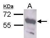 Sample (30 μg of whole cell lysate) A: Neuro2A GTX106566 diluted at 1:1000 The HRP-conjugated anti-rabbit IgG antibody (GTX213110-01) was used to detect the primary antibody.