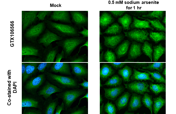 Staufen antibody detects Staufen protein by immunofluorescent analysis. Sample: Mock and treated HeLa cells were fixed in 4% paraformaldehyde at RT for 15 min. Green: Staufen stained by Staufen antibody (GTX106566) diluted at 1:500. Blue: Fluoroshield with DAPI (GTX30920).