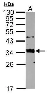 Sample (50 μg of whole cell lysate) A: mouse lung 12% SDS PAGE GTX106594 diluted at 1:500 The HRP-conjugated anti-rabbit IgG antibody (GTX213110-01) was used to detect the primary antibody.