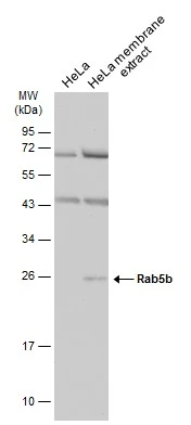 HeLa whole cell and membrane extracts (30 μg) were separated by 12% SDS-PAGE, and the membrane was blotted with Rab5b antibody (GTX106661) diluted at 1:500. The HRP-conjugated anti-rabbit IgG antibody (GTX213110-01) was used to detect the primary antibody.