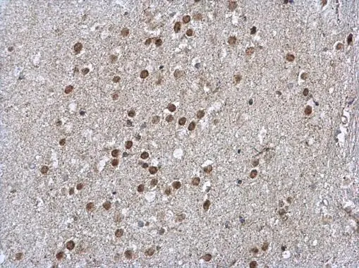LIMD1 antibody [C2C3], C-term detects LIMD1 protein at nucleus on mouse brain by immunohistochemical analysis. Sample: Paraffin-embedded mouse brain. LIMD1 antibody [C2C3], C-term (GTX106685) diluted at 1:500. 
 Antigen Retrieval: Trilogy? (EDTA based, pH 8.0) buffer, 15min