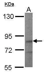 Sample (50 μg of whole cell lysate) A: Mouse brain 7.5% SDS PAGE GTX106685 diluted at 1:500 The HRP-conjugated anti-rabbit IgG antibody (GTX213110-01) was used to detect the primary antibody.
