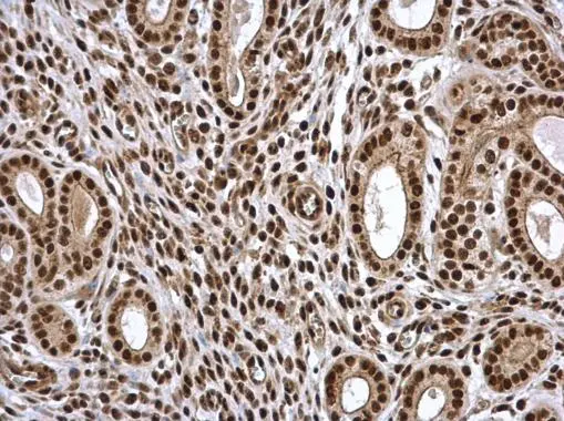 PSME3 antibody detects PSME3 protein at nucleus in mouse cervix by immunohistochemical analysis. Sample: Paraffin-embedded mouse cervix. PSME3 antibody (GTX106722) diluted at 1:500. 
 Antigen Retrieval: Citrate buffer, pH 6.0, 15 min