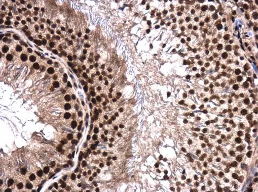 hnRNP H2 antibody detects hnRNP H2 protein at cytoplasm and nucleus in rat testis by immunohistochemical analysis. Sample: Paraffin-embedded rat testis. hnRNP H2 antibody (GTX106825) diluted at 1:500.
Antigen Retrieval: Citrate buffer, pH 6.0, 15 min hnRNP H2 antibody detects hnRNP H2 protein at cytoplasm and nucleus in rat testis by immunohistochemical analysis. Sample: Paraffin-embedded rat testis. hnRNP H2 antibody (GTX106825) diluted at 1:500.
Antigen Retrieval: Citrate buffer, pH 6.0, 15 min
