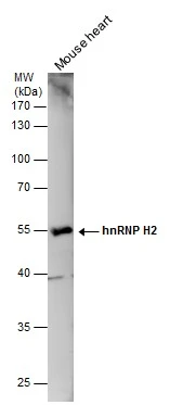 Mouse tissue extract (50 μg) was separated by 10% SDS-PAGE, and the membrane was blotted with hnRNP H2 antibody (GTX106825) diluted at 1:500. Mouse tissue extract (50 μg) was separated by 10% SDS-PAGE, and the membrane was blotted with hnRNP H2 antibody (GTX106825) diluted at 1:500.