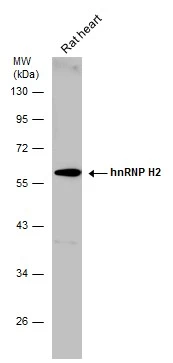 Rat tissue extract (50 μg) was separated by 10% SDS-PAGE, and the membrane was blotted with hnRNP H2 antibody (GTX106825) diluted at 1:500. Rat tissue extract (50 μg) was separated by 10% SDS-PAGE, and the membrane was blotted with hnRNP H2 antibody (GTX106825) diluted at 1:500.
