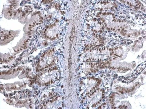U2AF35 antibody detects U2AF35 protein at nucleus on mouse intestine by immunohistochemical analysis. Sample: Paraffin-embedded mouse intestine. U2AF35 antibody (GTX106854) diluted at 1:1000. 
 Antigen Retrieval: Trilogy? (EDTA based, pH 8.0) buffer, 15min