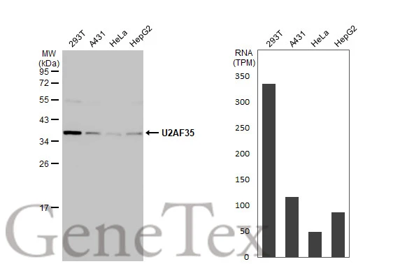 Various whole cell extracts (30 μg) were separated by 12% SDS-PAGE, and the membrane was blotted with U2AF35 antibody (GTX106854) diluted at 1:1000. The HRP-conjugated anti-rabbit IgG antibody (GTX213110-01) was used to detect the primary antibody. Corresponding RNA expression data for the same cell lines are based on Human Protein Atlas program.