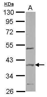Sample (50 μg of whole cell lysate) A: mouse brain 10% SDS PAGE GTX106942 diluted at 1:2000 The HRP-conjugated anti-rabbit IgG antibody (GTX213110-01) was used to detect the primary antibody.