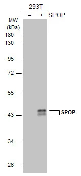 Non-transfected (–) and transfected (+) 293T whole cell extracts (30 μg) were separated by 10% SDS-PAGE, and the membrane was blotted with SPOP antibody [N1C1] (GTX106942) diluted at 1:5000. The HRP-conjugated anti-rabbit IgG antibody (GTX213110-01) was used to detect the primary antibody.