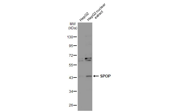 HepG2 whole cell and nuclear extracts (30 μg) were separated by 10% SDS-PAGE, and the membrane was blotted with SPOP antibody [N1C1] (GTX106942) diluted at 1:1000. The HRP-conjugated anti-rabbit IgG antibody (GTX213110-01) was used to detect the primary antibody.