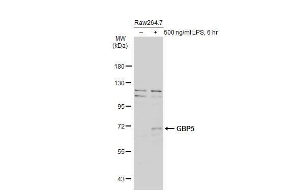 Untreated (–) and treated (+) Raw264.7 whole cell extracts (30 μg) were separated by 7.5% SDS-PAGE, and the membrane was blotted with GBP5 antibody [N1N3] (GTX106994) diluted at 1:500. The HRP-conjugated anti-rabbit IgG antibody (GTX213110-01) was used to detect the primary antibody, and the signal was developed with Trident ECL plus-Enhanced.