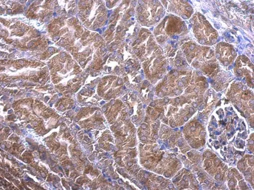 PHLP antibody detects PHLP protein at cytoplasm on mouse kidney by immunohistochemical analysis. Sample: Paraffin-embedded mouse kidney. PHLP antibody (GTX107089) dilution: 1:500.
Antigen Retrieval: Trilogy? (EDTA based, pH 8.0) buffer, 15min PHLP antibody detects PHLP protein at cytoplasm on mouse kidney by immunohistochemical analysis. Sample: Paraffin-embedded mouse kidney. PHLP antibody (GTX107089) dilution: 1:500.
Antigen Retrieval: Trilogy? (EDTA based, pH 8.0) buffer, 15min