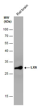 Rat tissue extract (50 μg) was separated by 12% SDS-PAGE, and the membrane was blotted with LXN antibody [N1C3] (GTX107116) diluted at 1:1000. The HRP-conjugated anti-rabbit IgG antibody (GTX213110-01) was used to detect the primary antibody.