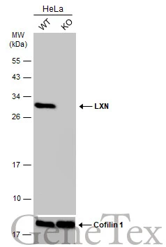 Wild-type (WT) and LXN knockout (KO) HeLa cell extracts (30 μg) were separated by 12% SDS-PAGE, and the membrane was blotted with LXN antibody [N1C3] (GTX107116) diluted at 1:3000. The HRP-conjugated anti-rabbit IgG antibody (GTX213110-01) was used to detect the primary antibody.