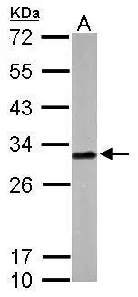 Sample (50 μg of whole cell lysate) A: mouse brain 12% SDS PAGE GTX107116 diluted at 1:1000 The HRP-conjugated anti-rabbit IgG antibody (GTX213110-01) was used to detect the primary antibody.