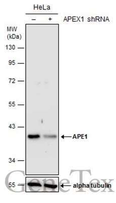 Non-transfected (–) and transfected (+) HeLa whole cell extracts (30 μg) were separated by 10% SDS-PAGE, and the membrane was blotted with APE1 antibody (GTX107122) diluted at 1:3000.