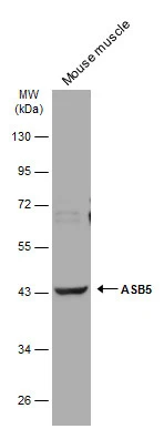 ASB5 antibody [N1C3]
