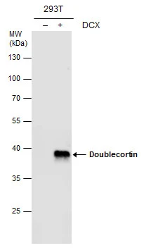 Doublecortin antibody detects Doublecortin protein by western blot analysis. Non-transfected (-) and Doublecortin-transfected (+, ) 293T whole cell extracts (30 μg) were separated by 10% SDS-PAGE, and the membrane was blotted with Doublecortin antibody (GTX107133) at a dilution of 1:1000.